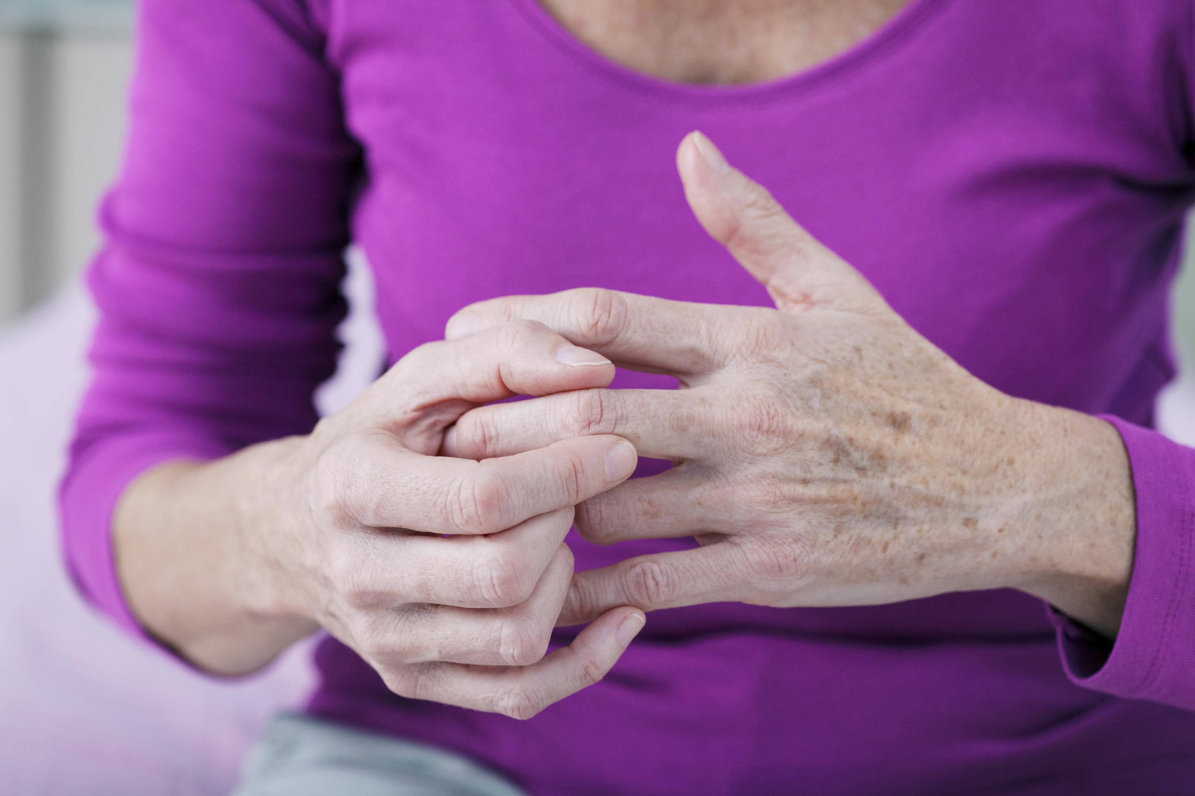 Arthritis