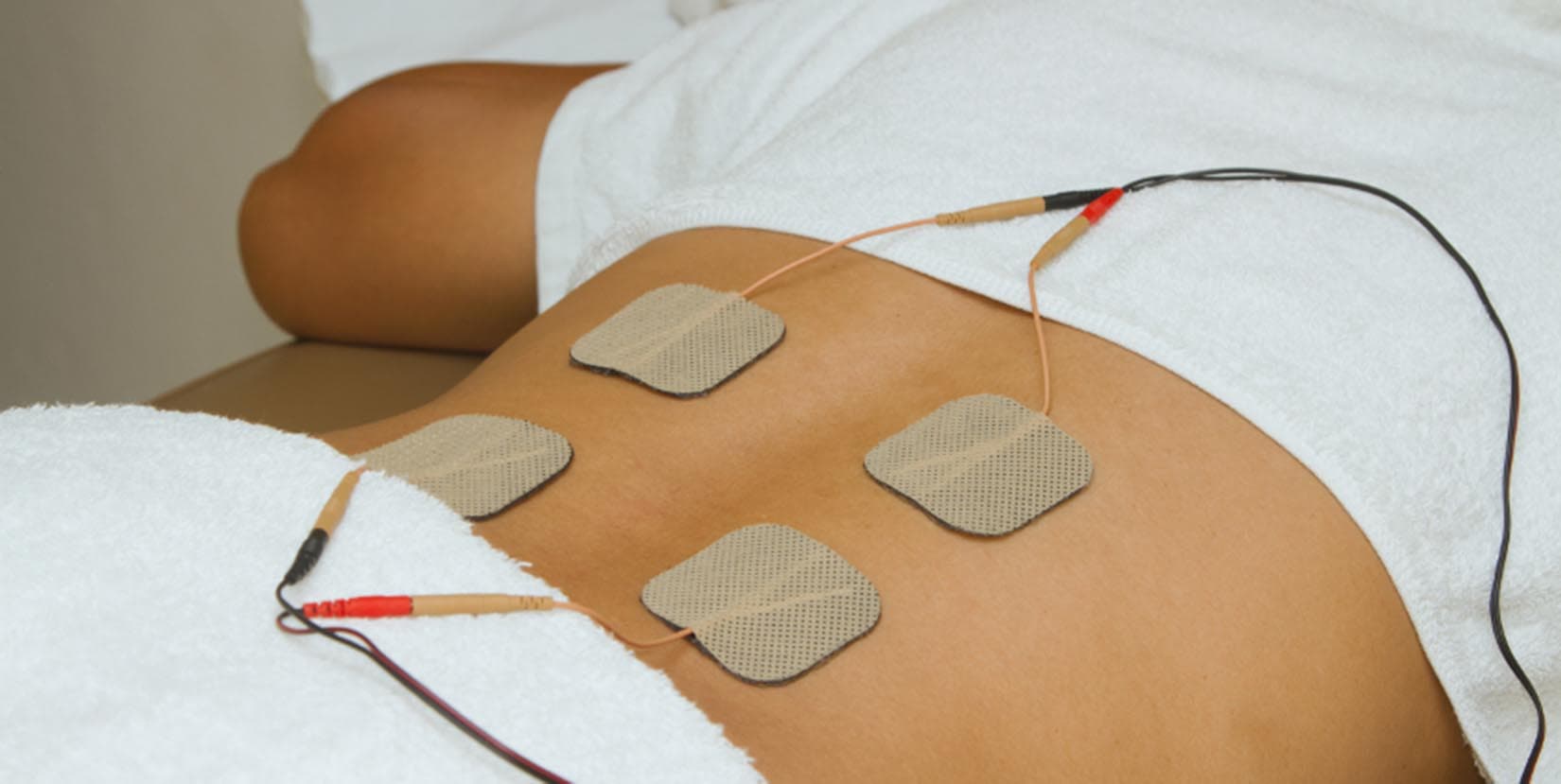 Electrical Stimulation (E-Stim)