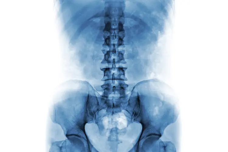 Digital X-Rays & Spinal Imaging